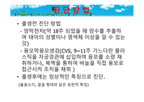 묘성 증후군과 윌리엄스 증후군-17