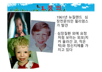 묘성 증후군과 윌리엄스 증후군-20