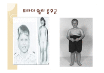 정신지체발표 - 프라더윌리 증후군 & 안젤만 증후군-3