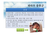 에드워드&파타우증후군 원인과 치료-12