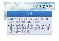 에드워드&파타우증후군 원인과 치료-14