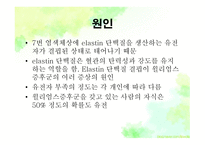 묘성&윌리엄스 정의, 원인, 진단, 특성-6