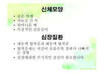 묘성&윌리엄스 정의, 원인, 진단, 특성-11