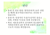 묘성&윌리엄스 정의, 원인, 진단, 특성-16