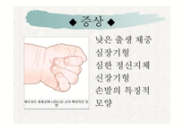 에드워드 증후군, 파타우 증후근, 근이 영양증-4