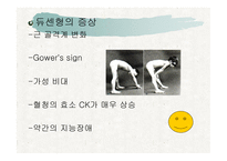 에드워드 증후군, 파타우 증후근, 근이 영양증-13