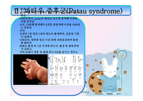 에드워드 파타우 PPT 정의, 원인-8