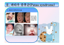 에드워드 파타우 PPT 정의, 원인-11