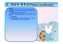 에드워드 파타우 PPT 정의, 원인-13