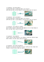PartialDenture디자인&기성 왁스-4