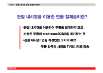 관절내시경을 이용한 반월상 연골절제술-4