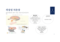 특수아동 교육지체 장애 및 건강장애-10