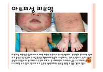 아동 건강교육 레포트-11