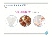 아동 건강교육 교사의 질병 주부습진-6