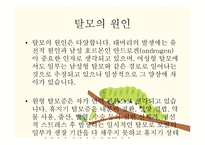 교사의 탈모 레포트-4