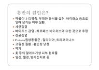폐기종 Emphysema요약-10