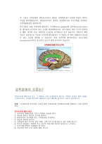 강박장애란 무엇인가 강박장애는 강박적 사고와 강박적 행동-2