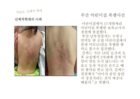 아동복지아동학대의 실태와 해결방안-8