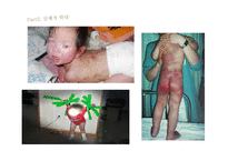 아동복지아동학대의 실태와 해결방안-10