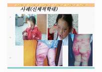 아동학대와 아동보호사업5-18