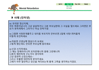 정신지체와 학습장애-18