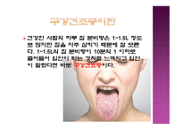 노인과 구강건조증-15