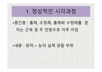 시각장애 개론 레포트-5