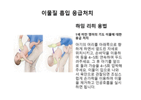 아동안전관리과 제이 물질 흡입 사례 응급조치-5