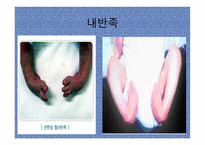 장애영유아의 이해-3