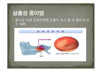 청각장애의 원인-9