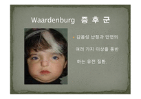 청각장애의 원인-17