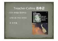 청각장애의 원인-20
