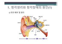청각 생리와 청각장애-3