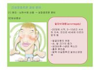 뇌하수체 장애 레포트-7