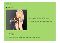 뇌하수체 장애 레포트-9