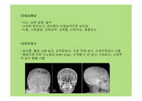 뇌하수체 장애 레포트-18
