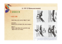 스포츠 재활 원리 치료의 개념-4