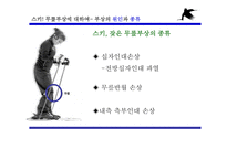 겨울 스포츠 스키와 무릎 부상-6