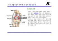 겨울 스포츠 스키와 무릎 부상-7