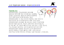 겨울 스포츠 스키와 무릎 부상-9