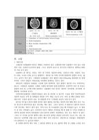 뇌출혈 후유증을 주소로 하는 여자 환자-2
