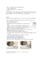 특별 구강 간호-5