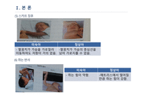 간호학 고위험 신생아의 특징 미숙아 과숙아-8