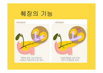 간호학 만성췌장염-2