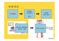 간호학 만성췌장염-5