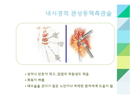 간호학 관상동맥 중재술-8