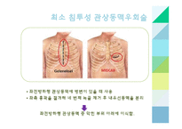 간호학 관상동맥 중재술-9