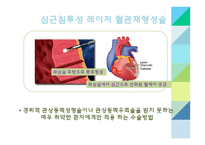 간호학 관상동맥 중재술-10