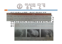 태내기와 신생아기-20