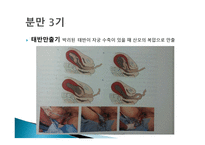 간호학 분만 기간호-4